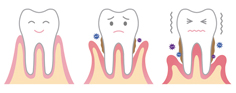 periodontal